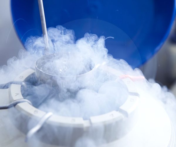 Einfrieren von Eizellen Kryokonservierung