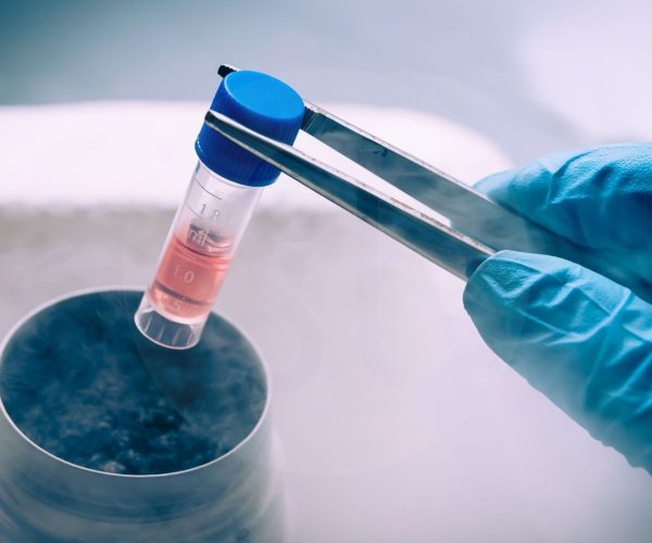 Gefrorener Embryotransfer FET