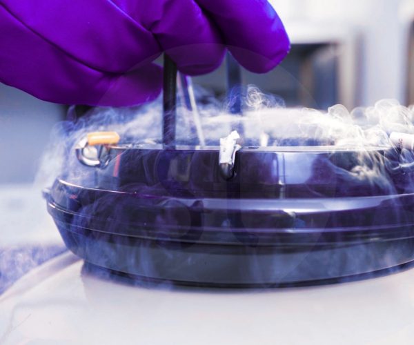 Sperma einfrieren Sperma kryokonservieren