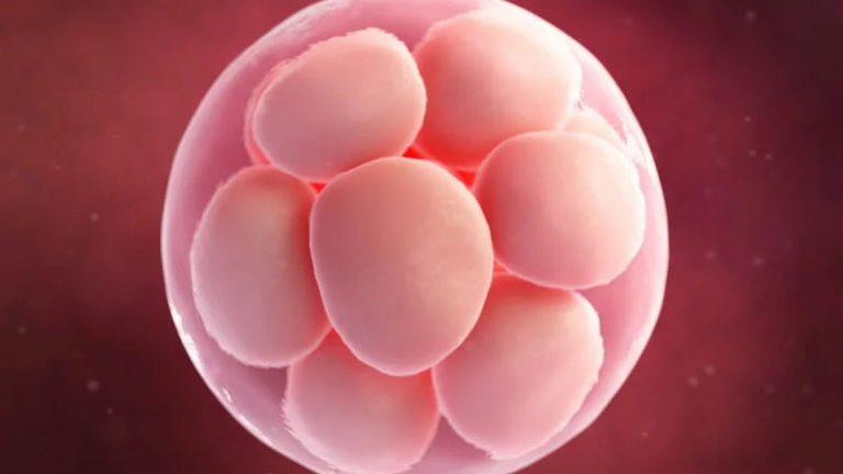 egg donation