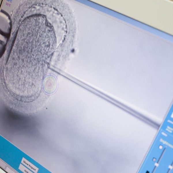 جينولايف للخصوبة في قبرص