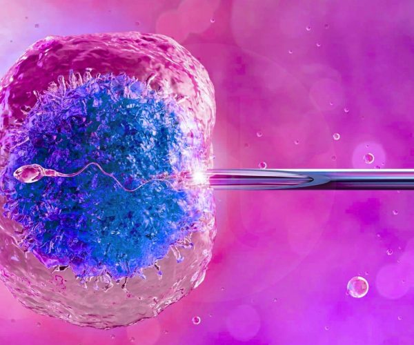 ICSI (Intrazytoplasmatische Spermieninjektion)