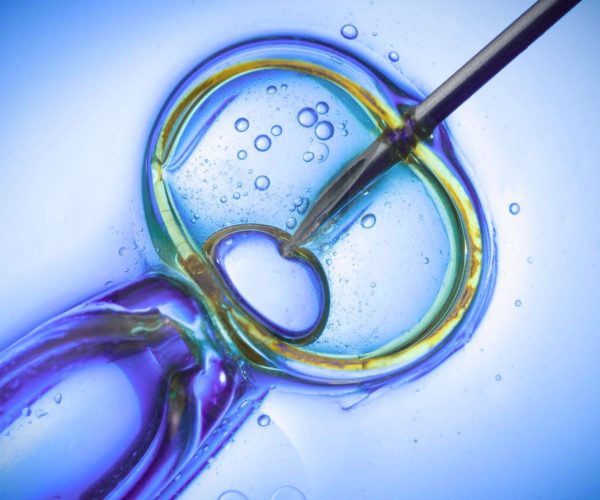 Infertility Treatment