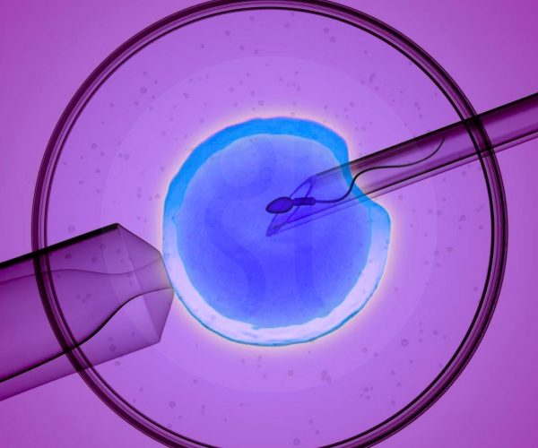 Микрочип IVF