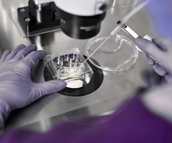 Mikrochirurgische TESE (Mikro-TESE)